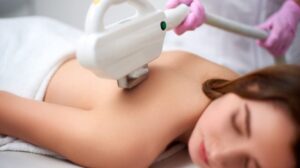 Process showing Radiofrequency Hair Removal