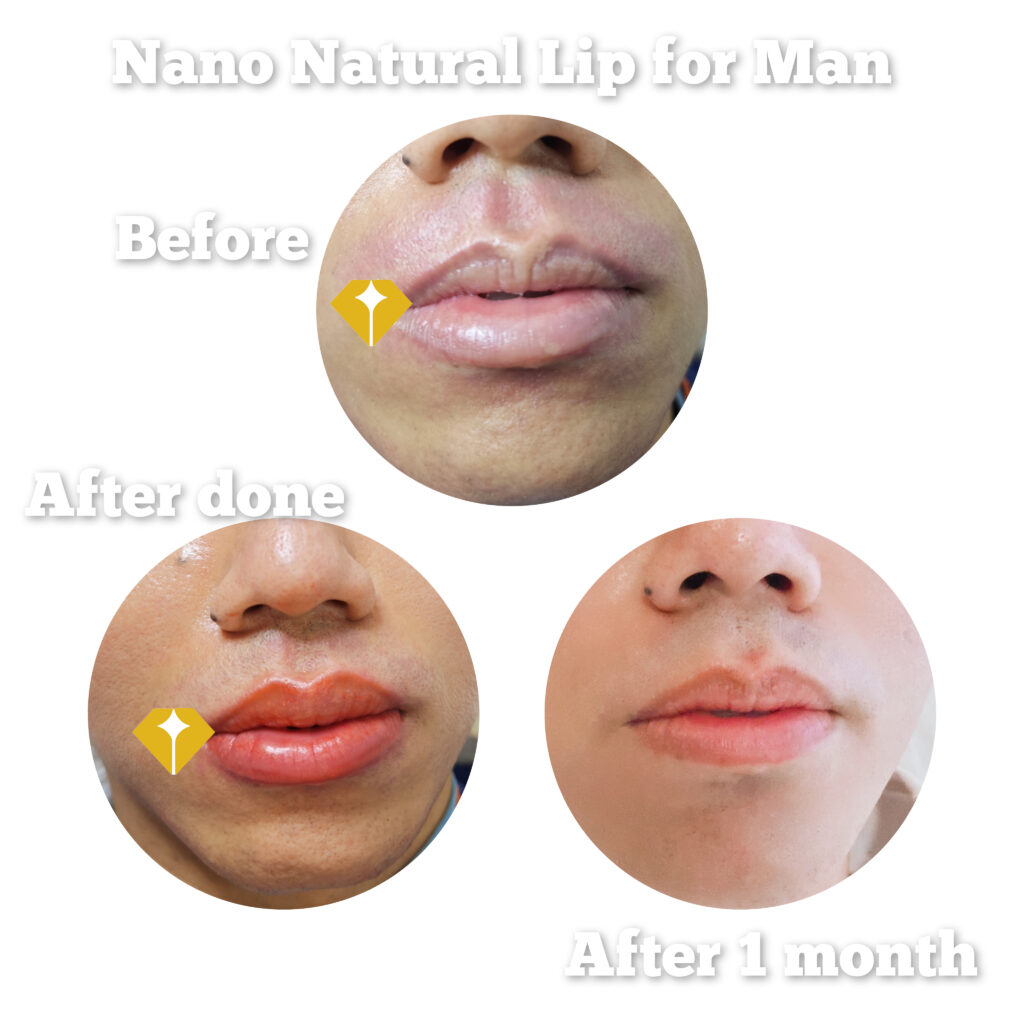 Nano Natural Lip Embroidery