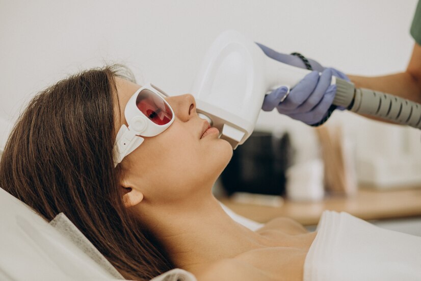 Diode Laser Hair Removal