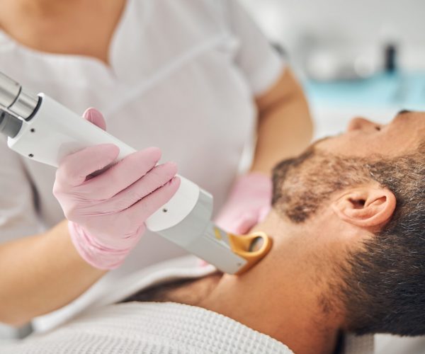 Beard Laser Hair Removal​