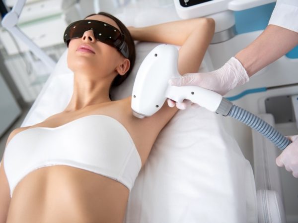 underarm laser hair removal