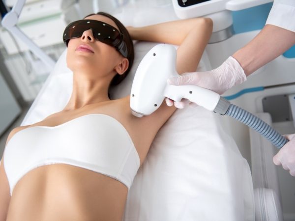 underarm laser hair removal